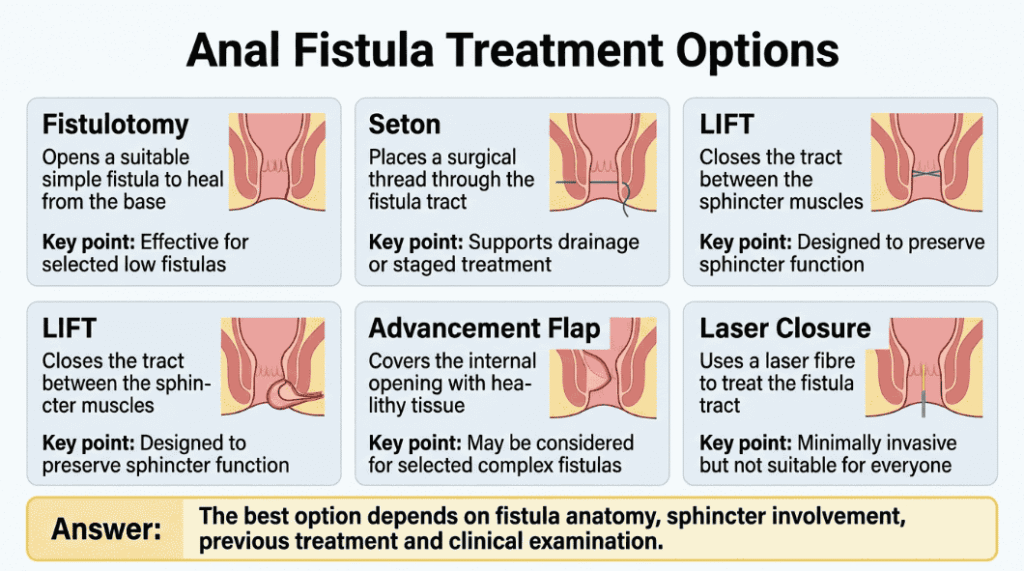 Anal fistula surgery cost in Bangladesh guide comparing fistulotomy, seton, LIFT, flap and laser treatment