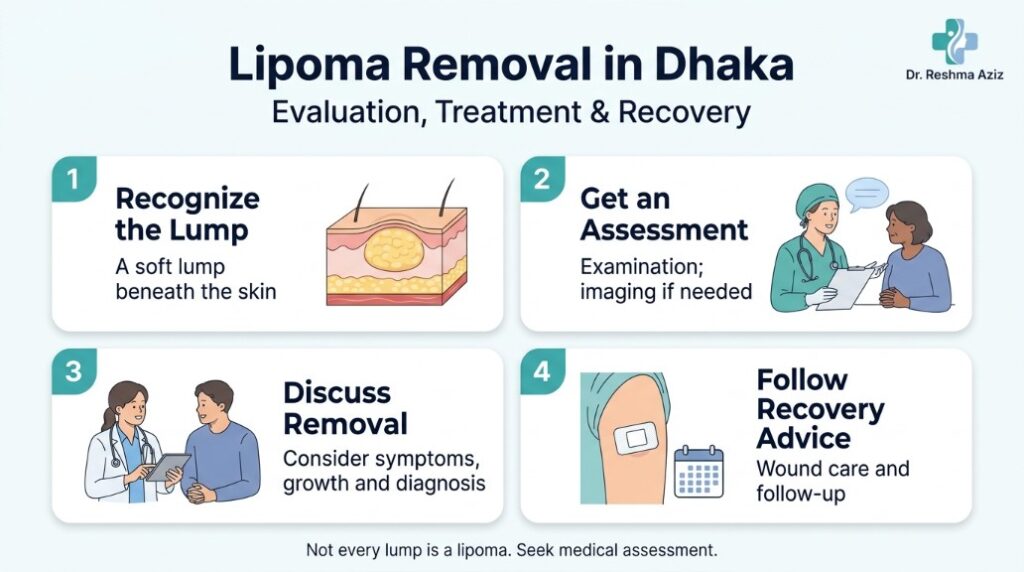 Infographic on lipoma removal in Dhaka showing lump recognition, assessment, removal discussion, and recovery care.