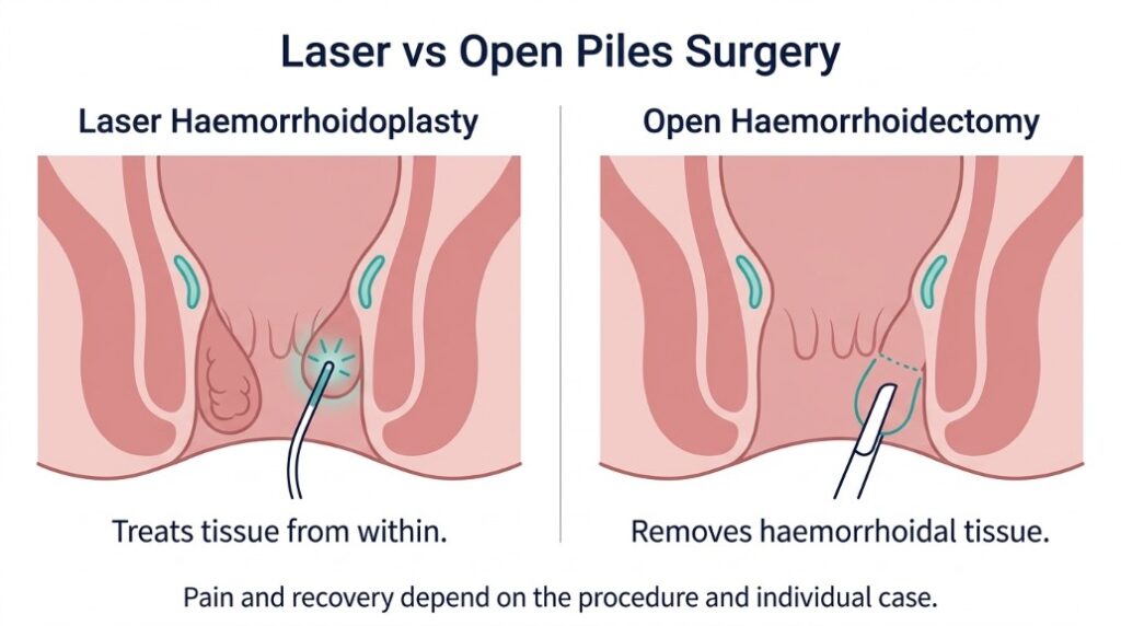 Recovery timeline showing soreness and healing stages for patients asking is laser piles surgery painful.